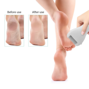 Ηλεκτρική Λίμα για Φτέρνες και Κάλους - Electric Foot File YH-008